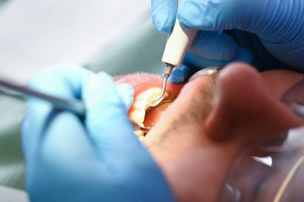 Best Weekend Emergency Dentist in Wahpeton, ND