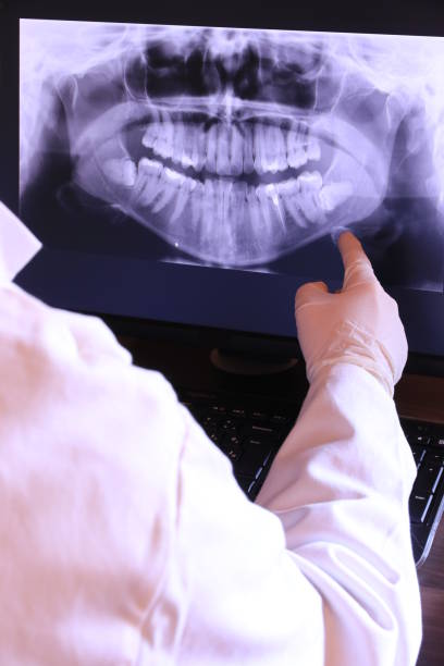 Best Emergency Dental Care for Broken or Chipped Teeth in Wahpeton, ND